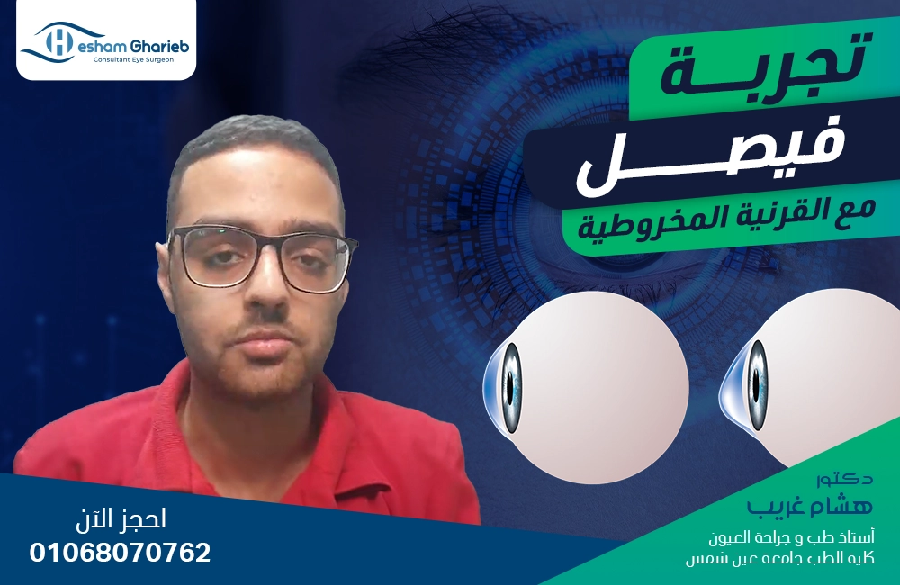 القرنية المخروطية