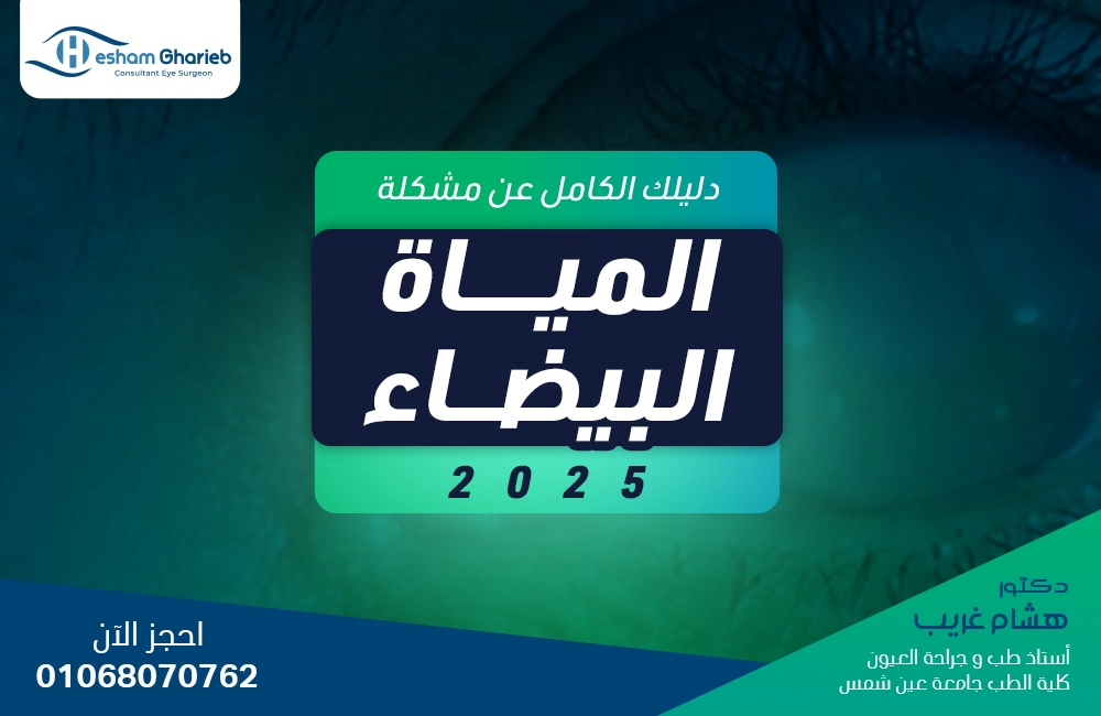 المياة البيضاء