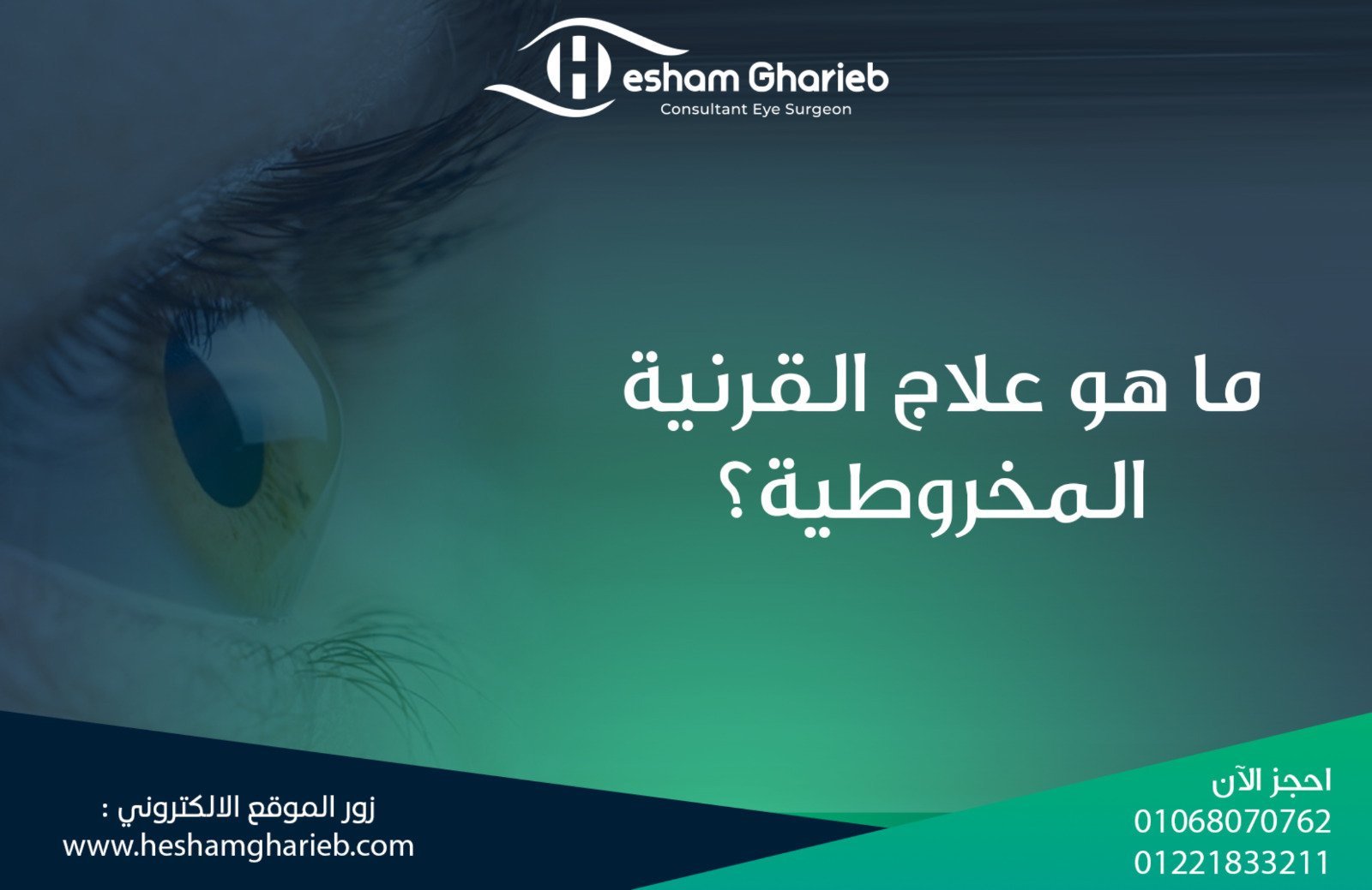 علاج القرنية المخروطية