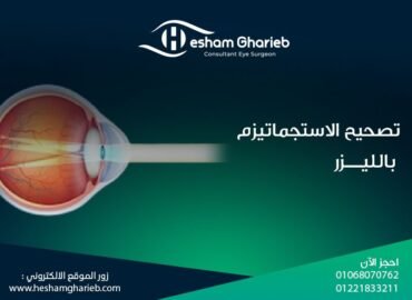 تصحيح الاستجماتيزم بالليزر