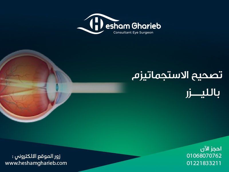 تصحيح الاستجماتيزم بالليزر