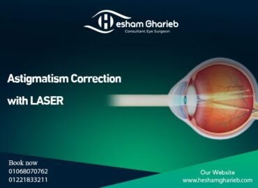 Astigmatism Correction with LASER