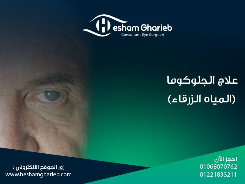 علاج الجلوكوما