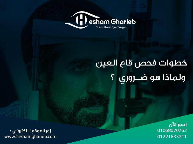 فحص قاع العين