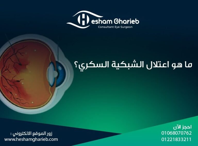 ما هو اعتلال الشبكية السكري