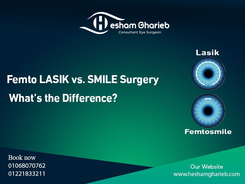 تصحيح الاستجماتيزم بالليزر
