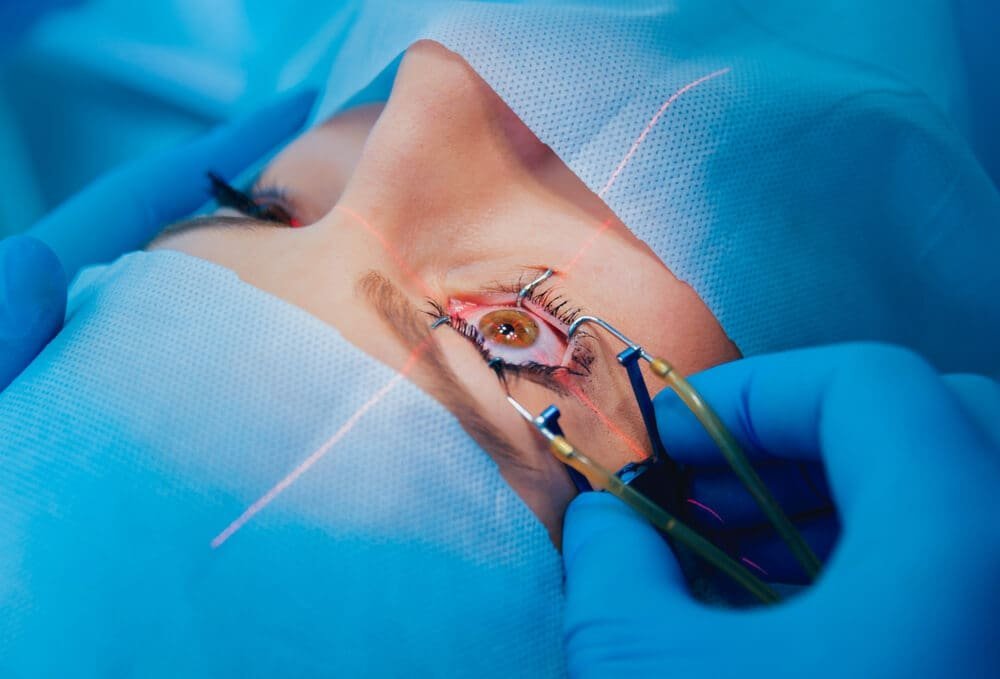 Eye correction Surgery